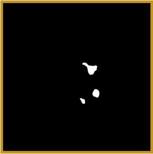 Predicted GA segmentation